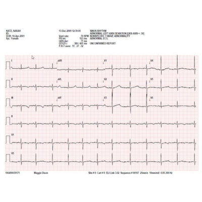 EKG-papier voor Mortara ELi 230 - rol 210x20m - 5 st